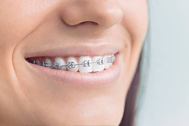 Best Dental Fillings (Composite and Amalgam)  in Wilson, PA